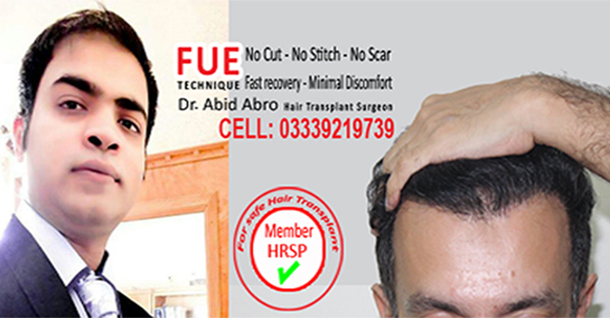 Hair Transplant Center Karachi FUE Hair Transplant | FUT Hair Transplant